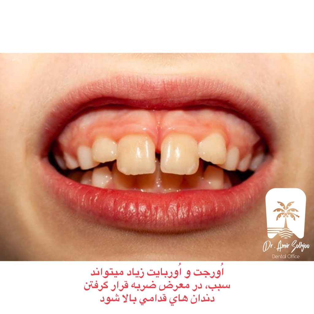 اورجت و اوربایت