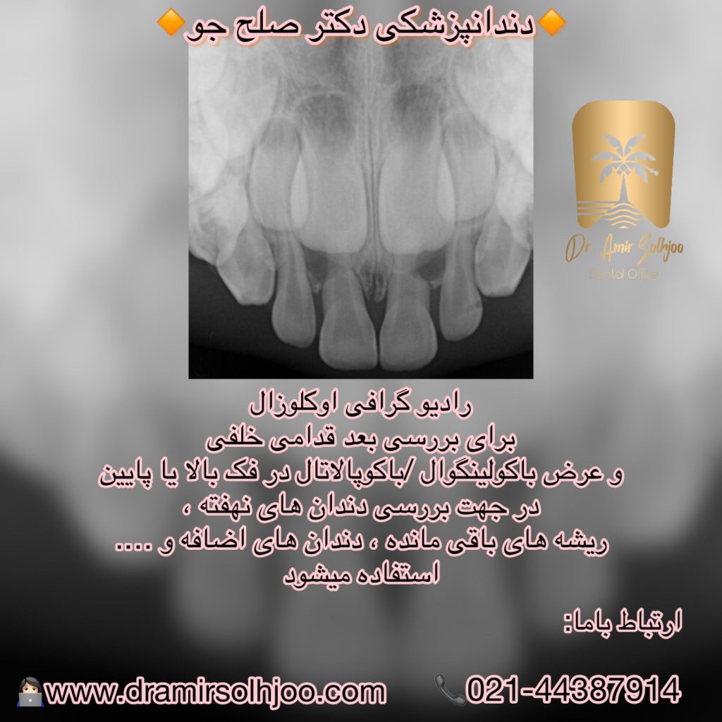 رادیوگرافی اکلوزال