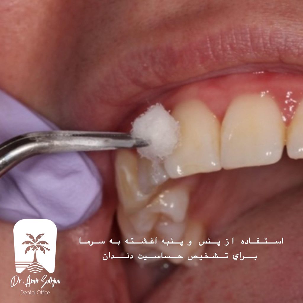 پنس رول پنبه