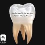 دندان مولر یا آسیاب بزرگ