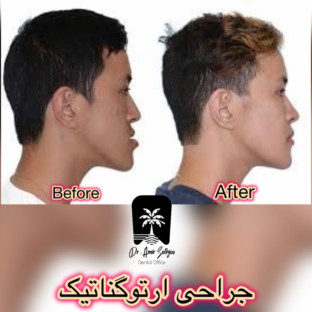 ارتوسرجری