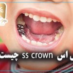 اس اس  ss crown