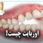 اور بایت