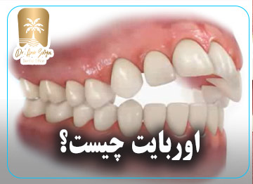 اور بایت