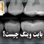 بایت وینگ چیست؟
