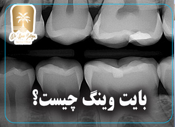 بایت وینگ چیست؟