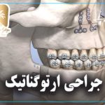 جراحی ارتوگناتیک