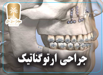 جراحی ارتوگناتیک