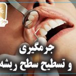 جرمگیری و تسطیح سطح ریشه