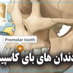 دندان های بای کاسپید