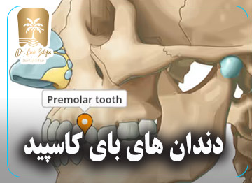 دندان های بای کاسپید