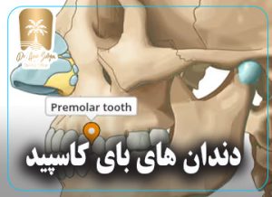 دندان های بای کاسپید