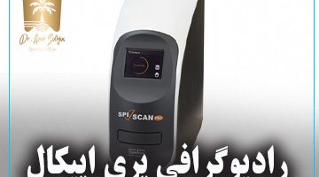 رادیوگرافی پری اپیکال