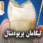 لیگامان پریودنتال