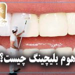 هوم بلیچینگ چیست؟