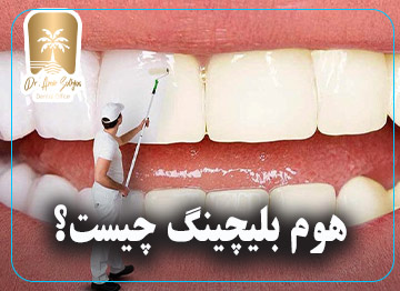 هوم بلیچینگ چیست؟