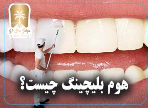 هوم بلیچینگ چیست