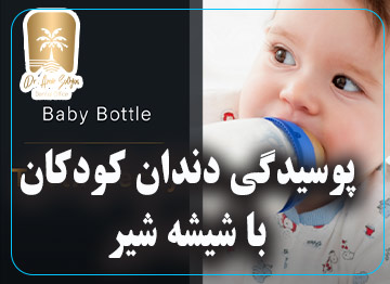 پوسیدگی زودرس دندان ها