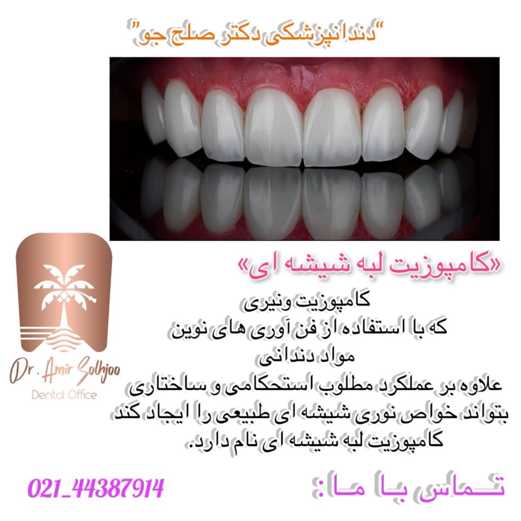 کامپوزیت لبه شیشه ای چیست