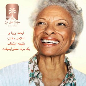 چگونه ایمپلنت خوب انتخاب کنیم