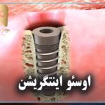 اوسئو اینتگریشن