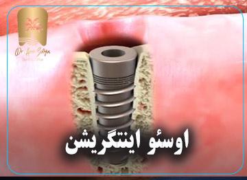 اوسئو اینتگریشن