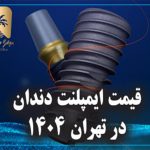 قیمت ایمپلنت دندان در تهران 1404