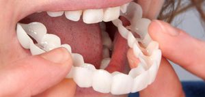 مضرات لمینت متحرک