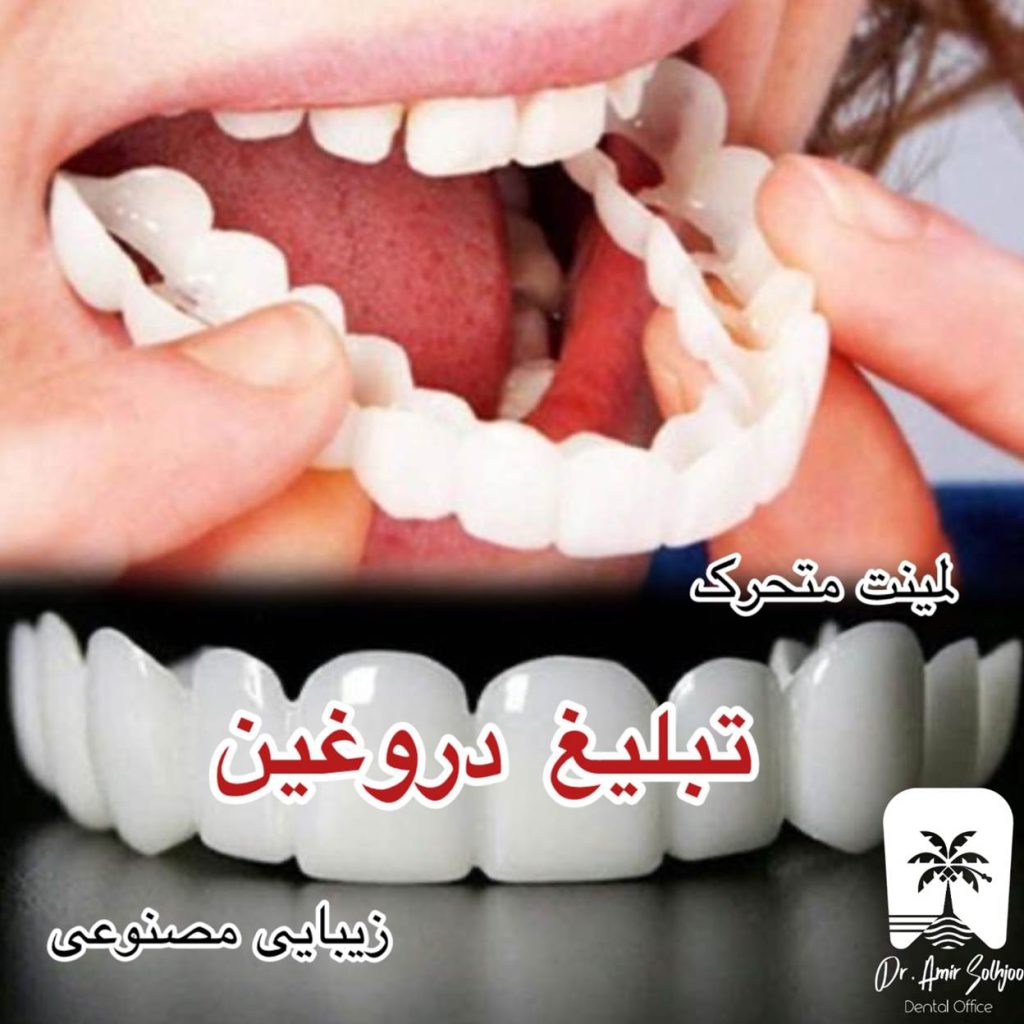 لمینت متحرک بخریم یا نه