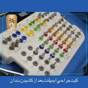 نقش ایمپلنتهای دیجیتال در دندانپزشکی مدرن