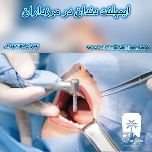 مراقبت های بعد از ایمپلنت دندان