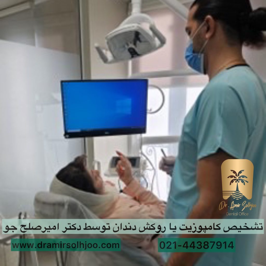 تشخیص کامپوزیت یا روکش کردن