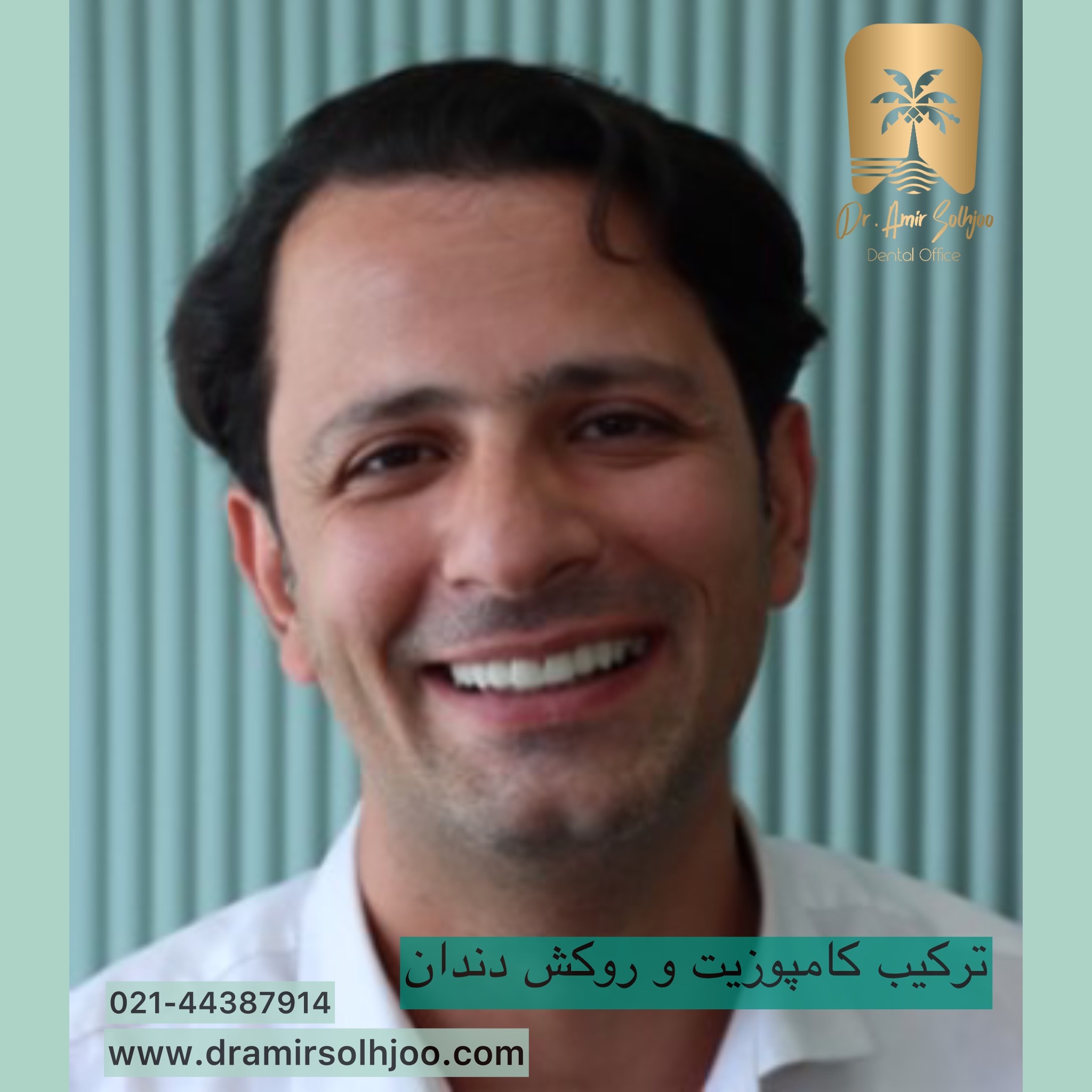کامپوزیت یا روکش