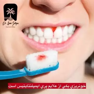 خونریزی هنگام مسواک زدن