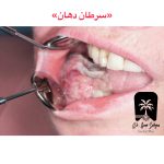 دسنسیتایزر