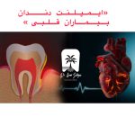 ایمپلنت دندان بیماران قلبی
