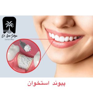 پودر استخوان