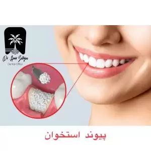 پودر استخوان