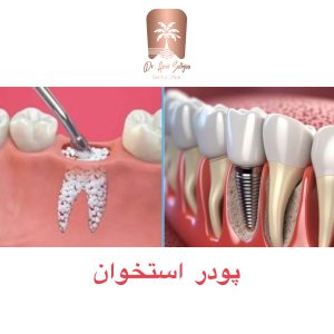 پودر استخوان