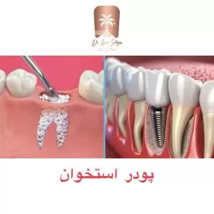پودر استخوان