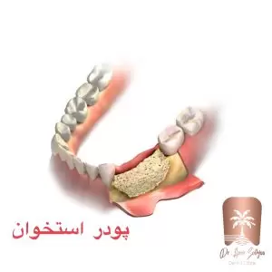 انواع پودر استخوان