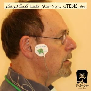 روش تنس درمان اختلال مفصل گیجگاهی