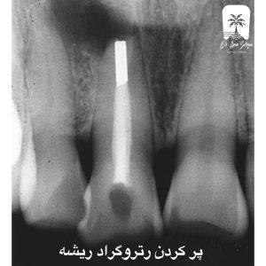 رتروگراد