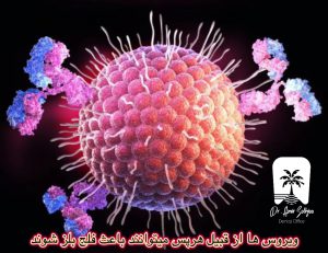 فلج بلز
