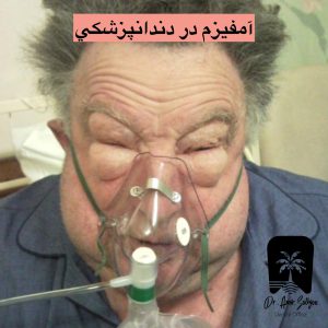 مشکل تنفسی