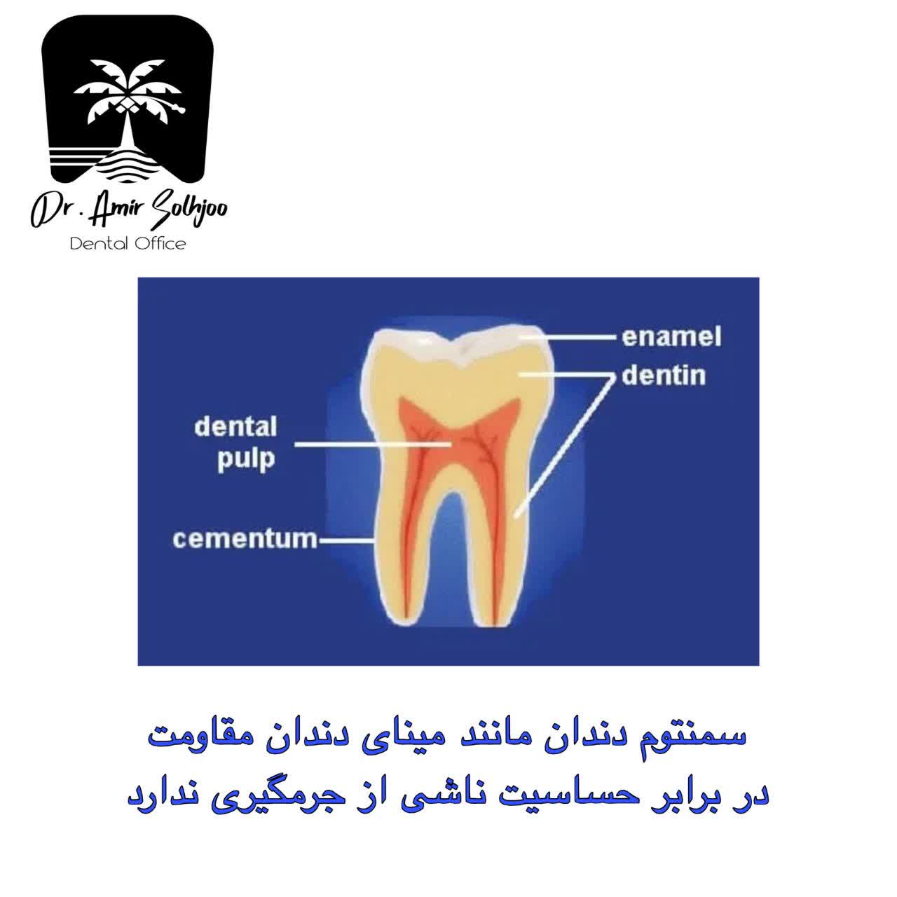 سمنتوم دندان