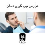 عوارض جرمگیری دندان