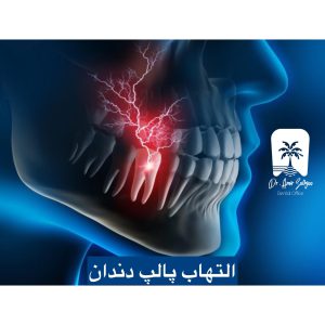 کاهش درد و ناراحتی دندان