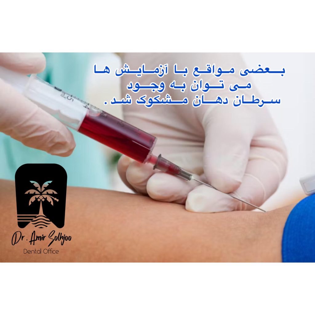 آزمایش خون سرطان