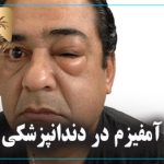 آمفیزم